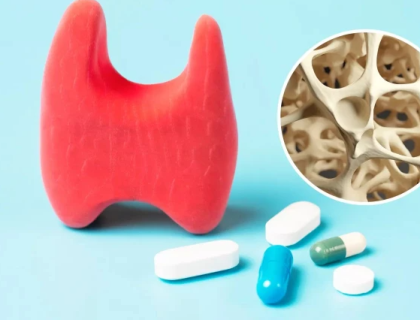 تھائیرائیڈ کی عام دوا ہڈیوں کی کمزوری سے منسلک ہوسکتی ہے، ماہرین