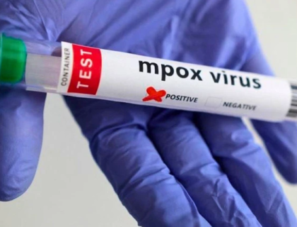 خیبر پختونخوا میں ایم پاکس کا چھٹا کیس سامنے آگیا