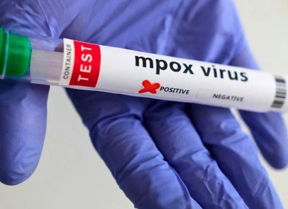 خیبر پختونخوا میں ایم پاکس کا چھٹا کیس سامنے آگیا