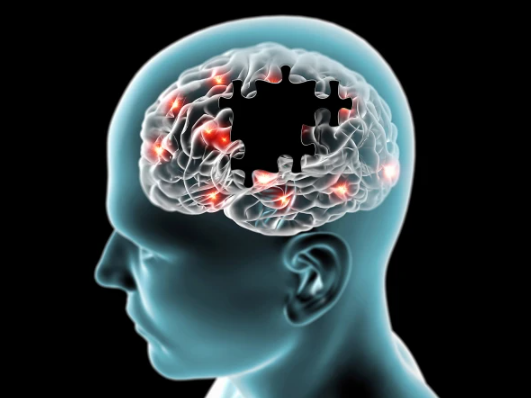 ٹائپ 2 ذیابیطس والے لوگوں میں ٹائپ 3 ذیابیطس کا خطرہ بھی زیادہ ہوتا ہے