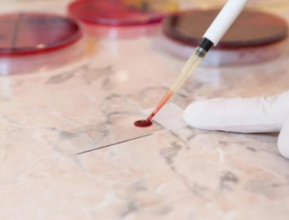 خون کے ٹیسٹ سے متعدد کینسرز کا قبل از وقت پتہ لگایا جاسکتا ہے، تحقیق