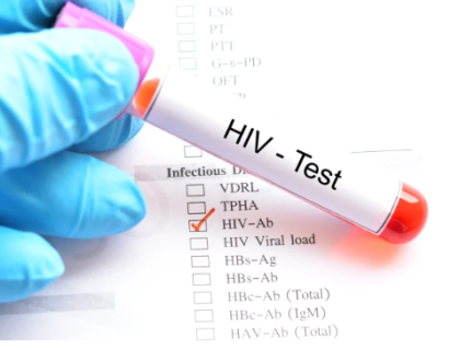 ایچ آئی وی کے علاج کی تلاش میں اہم کامیابی