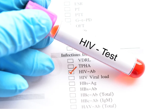 ایچ آئی وی کے علاج کی تلاش میں اہم کامیابی