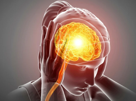موسمیاتی تبدیلیاں دردِ شقیقہ Migraine یا دیگر اقسام کے سر درد کا سبب بن سکتی ہیں