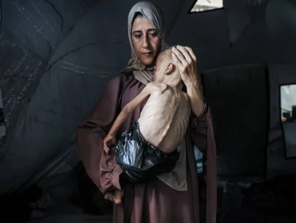 غزہ میں شدید غذائی قلت کا شکار بچوں کی تعداد 28 ہزار سے تجاوز کرگئی