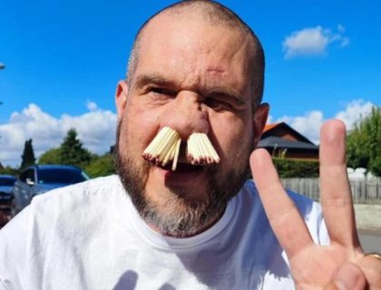 سوئیڈن, ناک میں 81 ماچس کی تیلیاں پھنسانے کا انوکھا ریکارڈ