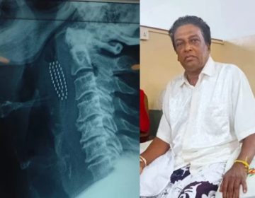 دانتوں کی صفائی نے موت کے منہ تک پہنچا دیا