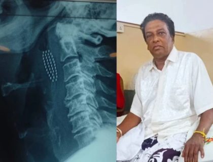 دانتوں کی صفائی نے موت کے منہ تک پہنچا دیا