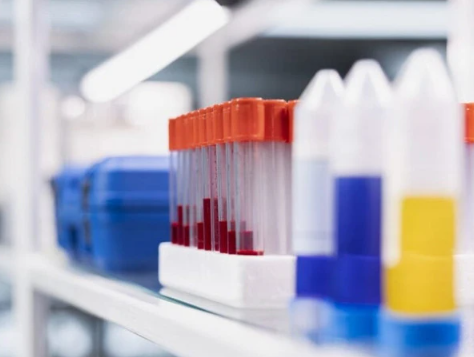 سائنس دانوں نے ٹی بی کے لیے نئی ٹیسٹ ٹیکنالوجی تیار کرلی