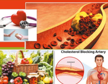 ہائی کولیسٹرول دل کو متاثر کرسکتا ہے